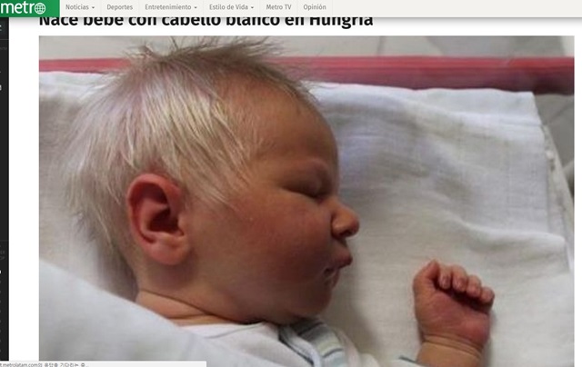 '백발이 성성한' 갓난아기? '메트로 푸에르토리코'는 헝가리에서 태어난 '백발'의 갓난아기 벤스 사연을 보도했다./'메트로 푸에르토리코' 홈페이지 캡처