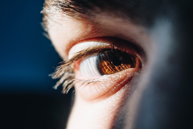Ilustrasi mata: Foto: unsplash.com