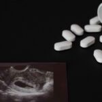 Ilustrasi Aborsi